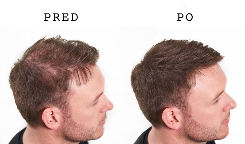 pribehy-adam-pred-po-profil.jpg
