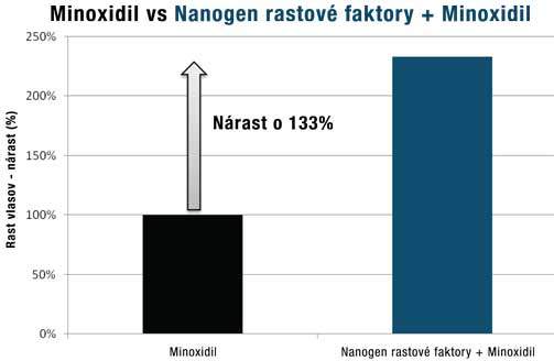 minoxidil vs nanogen sérum