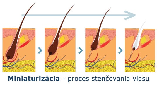 Miniaturizacia - proces stenčovania vlasu