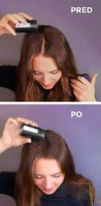 husté vlasy pred a pod použití nanogen